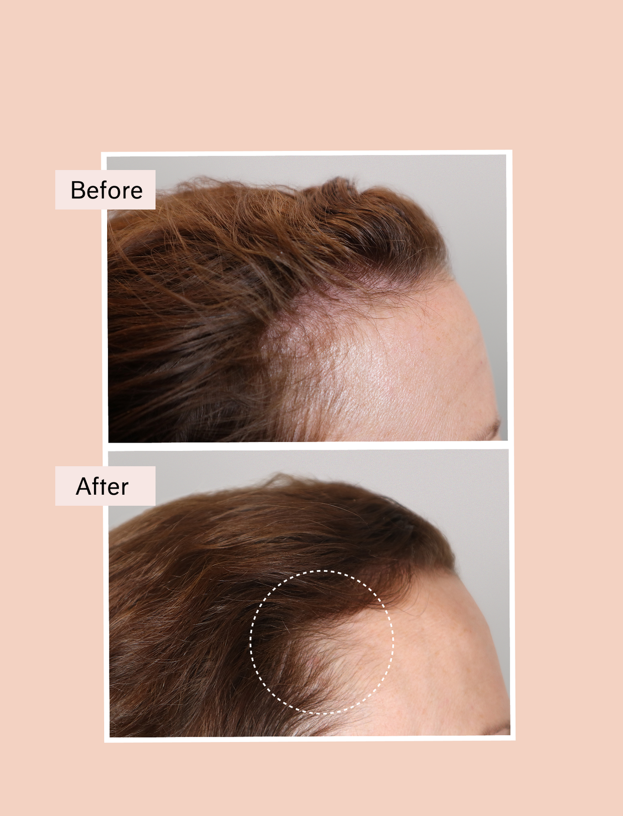 growth serum