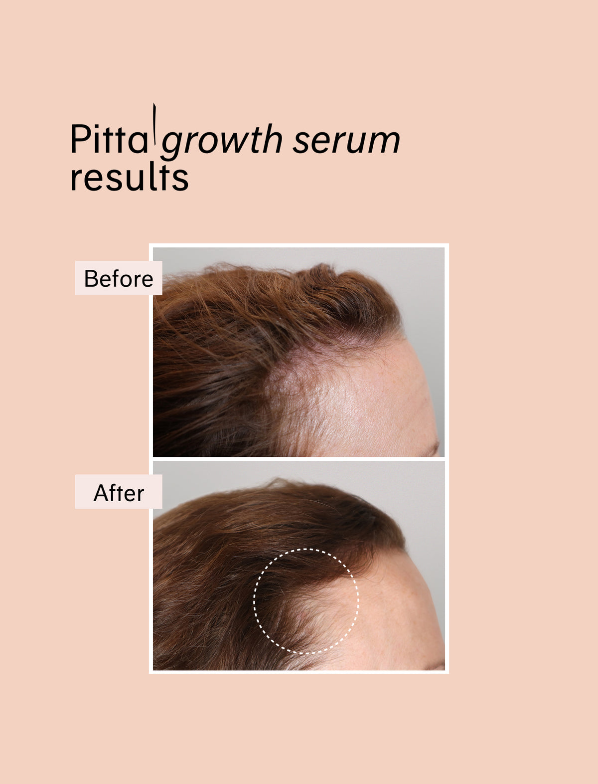 grow & repair duo