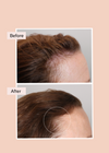 growth serum