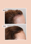 volumising system