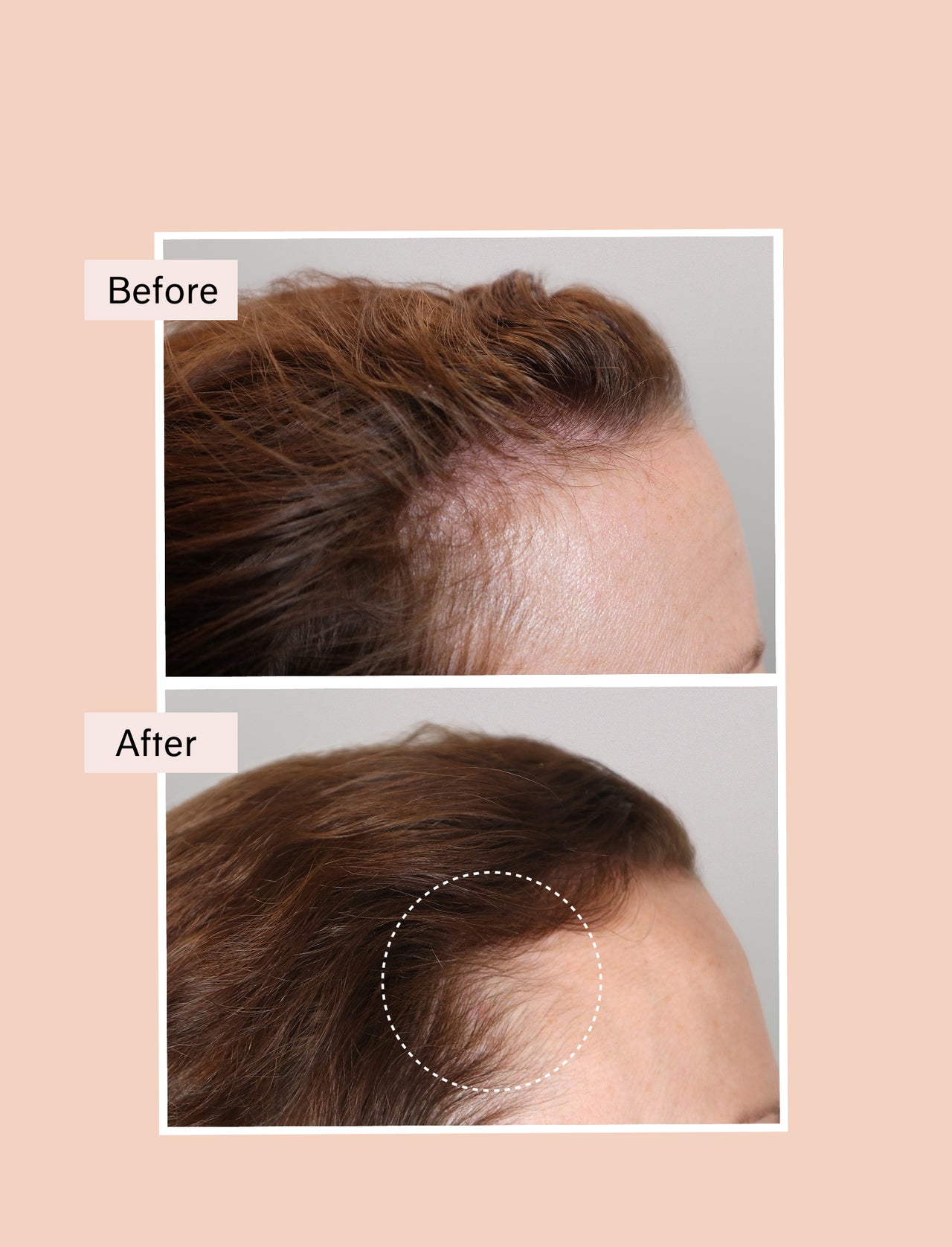 volumising system